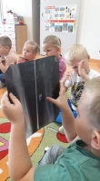Zdjęcie: Zdjęcie rentgenowskie.